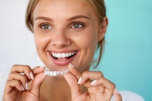 Beneficiile unui aparat dentar Invisalign