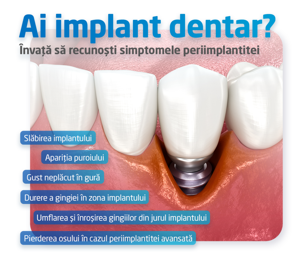 periimplantita, implant dentar, simptomele periiimplantitei infografic | Clinicile Trident