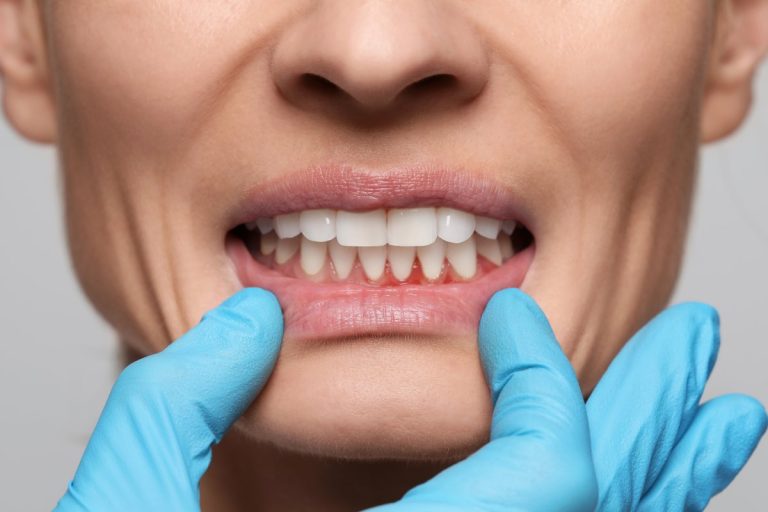 pacient cu sangerari gingivale in timpul unui consult stomatologic