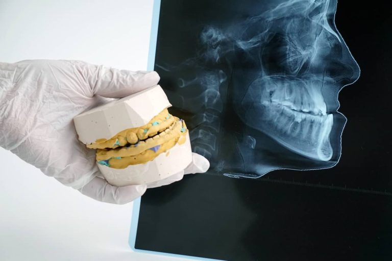medic, mulaj dentar si radiografie ce arata o malocluzie
