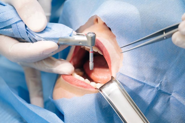pacienta in timpul intervenției chirurgicale pentru inserarea unui implant dentar